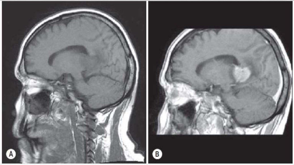 Contrast media in radiology