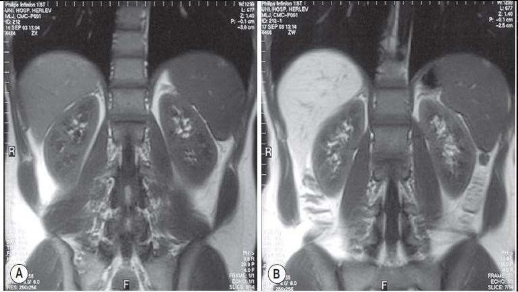 Contrast media in radiology