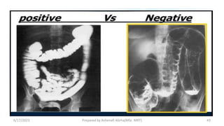 6/17/2023 Prepared by Ashenafi Abrha(MSc MRT) 43
 