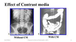 Effect of Contrast media
6/17/2023 Prepared by Ashenafi Abrha(MSc MRT) 6
Without CM With CM
B
A
 