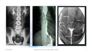 6/17/2023 Prepared by Ashenafi Abrha(MSc MRT) 7
 
