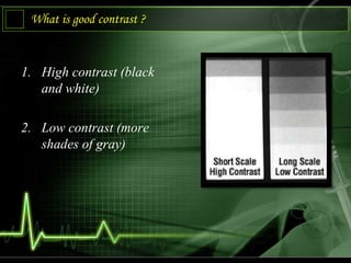 What is good contrast ?
1. High contrast (black
and white)
2. Low contrast (more
shades of gray)
 