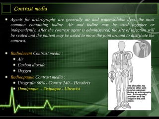 Contrast media 4 | PPTX