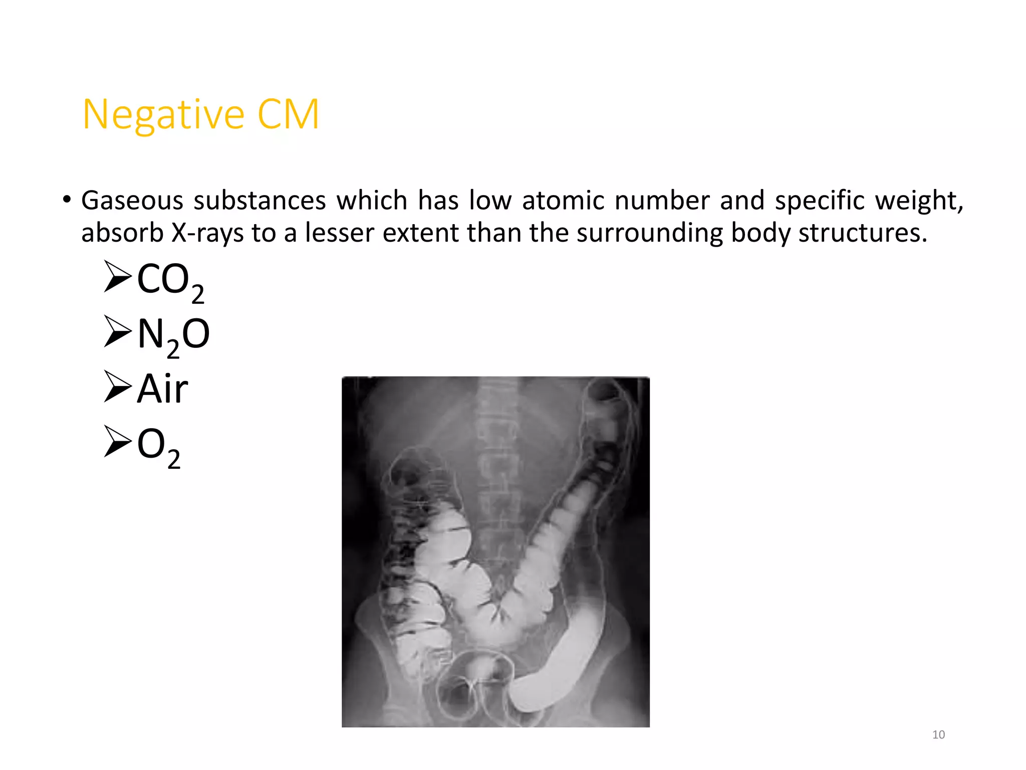 Negative CM
• Gaseous substances which has low atomic number and specific weight,
absorb X-rays to a lesser extent than the surrounding body structures.
CO2
N2O
Air
O2
10
 