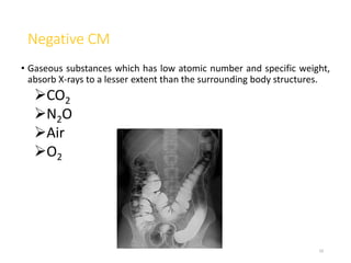 Negative CM
• Gaseous substances which has low atomic number and specific weight,
absorb X-rays to a lesser extent than the surrounding body structures.
CO2
N2O
Air
O2
10
 
