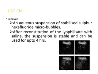 USG CM
• SonoVue
An aqueous suspension of stabilised sulphur
hexafluoride micro-bubbles.
After reconstitution of the lyophilisate with
saline, the suspension is stable and can be
used for upto 4 hrs.
46
 