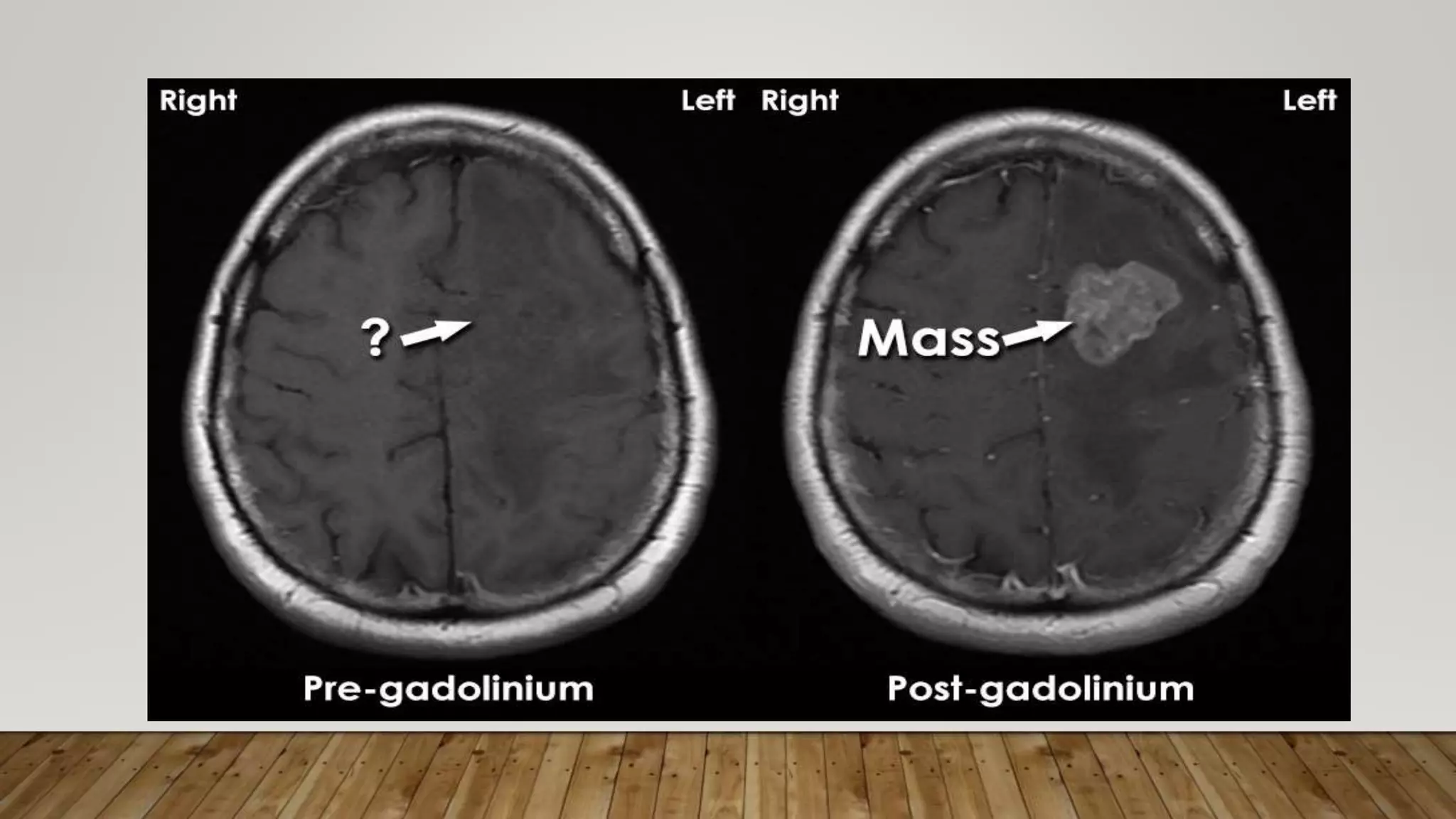 Contrast media OF MRI.pptx