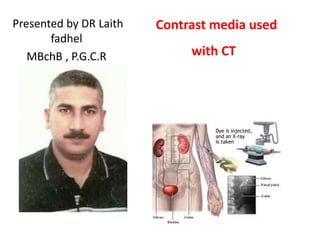 Presented by DR Laith
fadhel
MBchB , P.G.C.R

Contrast media used
with CT

 