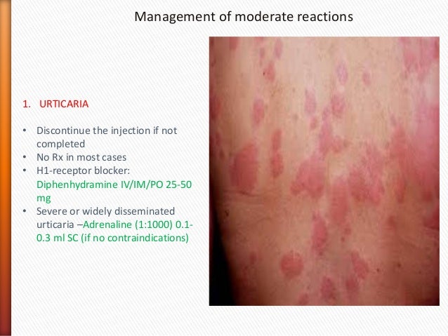 Contrast Reactions contrast-reactions