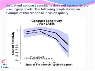 the patient contrast sensitivity does not recover to the
presurgery levels. The following graph shows an
example of this response in vision quality
 
