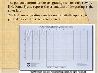  The patient determines the last grating seen for each row (A, 
B, C, D and E) and reports the orientation of the grating: right, 
up or left. 
 The last correct grating seen for each spatial frequency is 
plotted on a contrast sensitivity curve. 
 