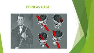 PHINEAS GAGE
 