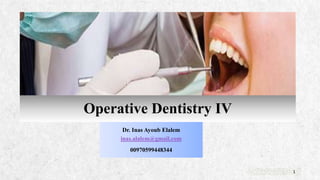 ALPINE SKI HOUSE
Dr. Inas Ayoub Elalem
inas.alalem@gmail.com
00970599448344
1
Operative Dentistry IV
 
