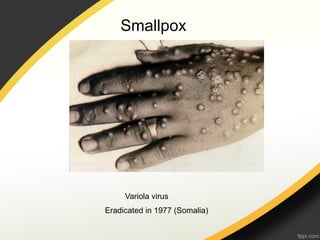 Smallpox




     Variola virus
Eradicated in 1977 (Somalia)
 