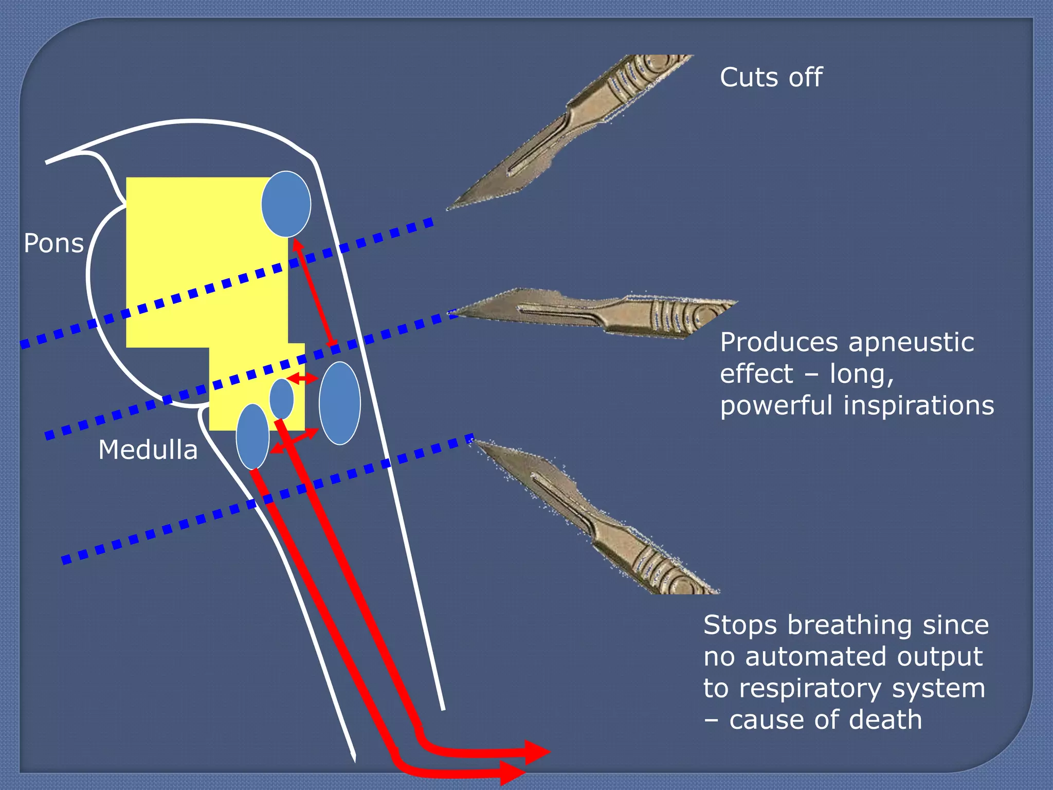Pons
Medulla
Cuts off
Produces apneustic
effect – long,
powerful inspirations
Stops breathing since
no automated output
to respiratory system
– cause of death
 