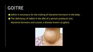 GOITRE
● Iodine is necessary for the making of thyroxine hormone in the body.
● The deficiency of iodine in the diet of a person produces less
thyroxine hormone and causes a disease known as goitre.
 