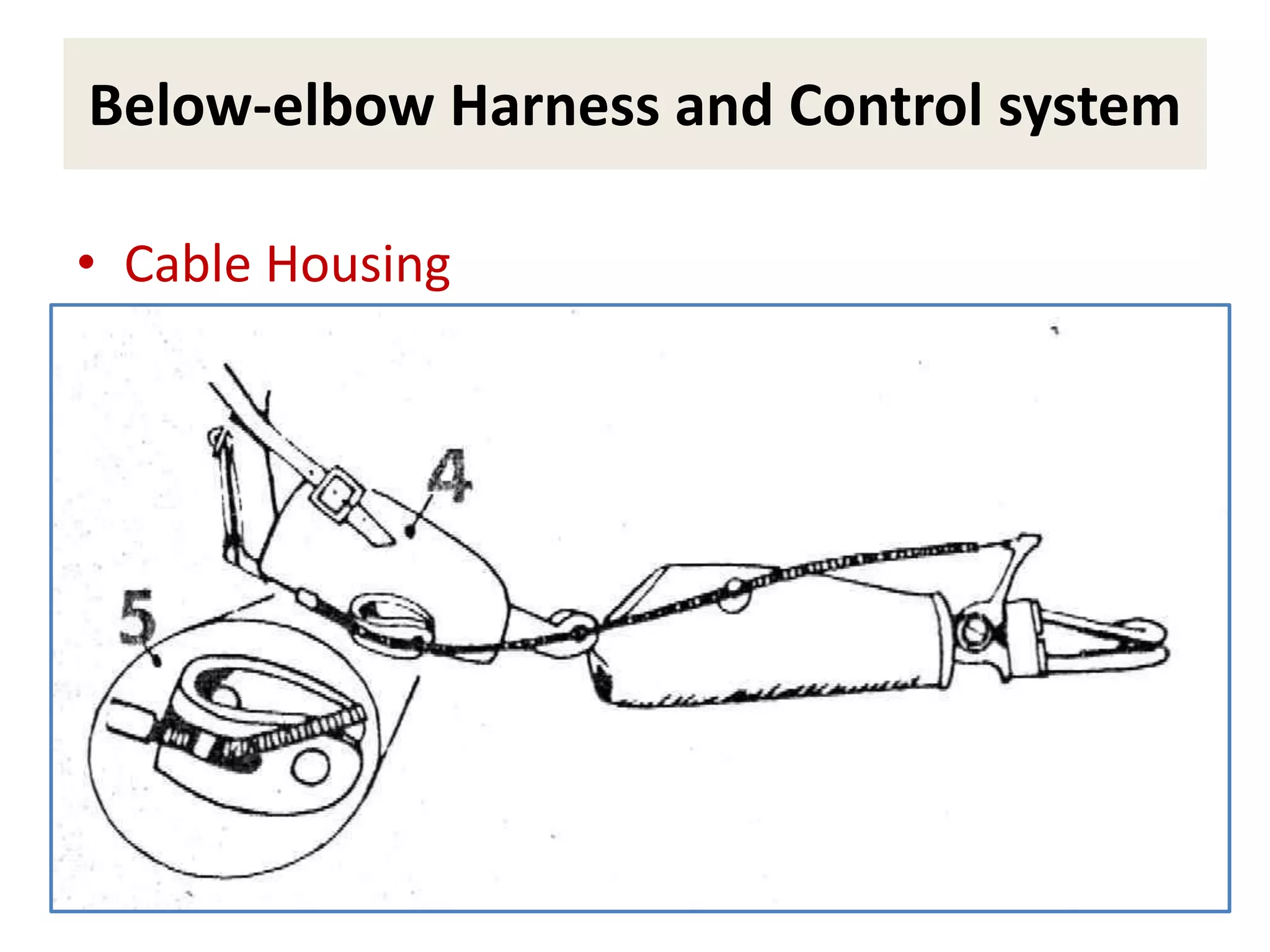 Control and harness sysrem for be and ae prosthetic management | PPTX