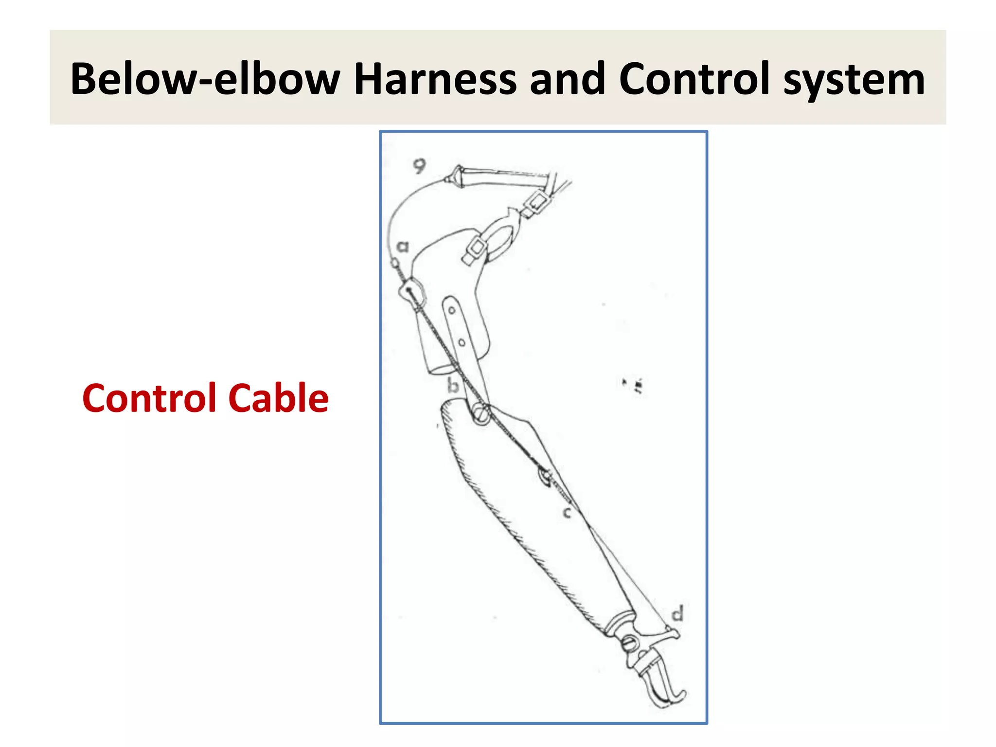 Control and harness sysrem for be and ae prosthetic management | PPTX