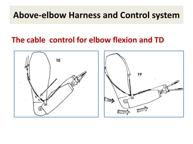 Control and harness sysrem for be and ae prosthetic management | PPTX ...