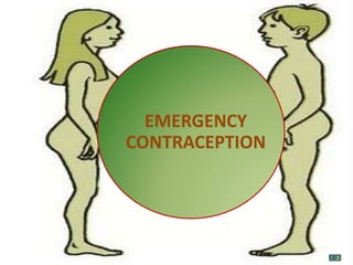 EMERGENCY
CONTRACEPTION
 