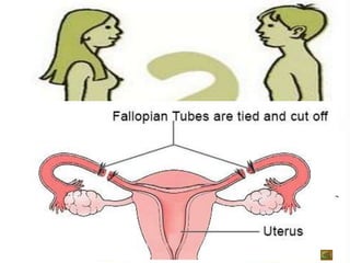Control birth