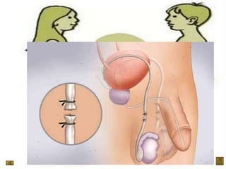 Control birth