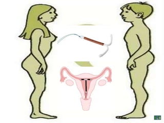 Control birth