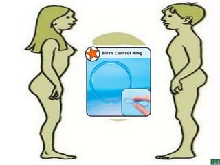 Control birth