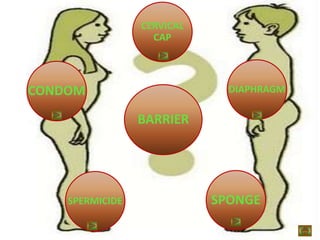 BARRIER
CONDOM
SPERMICIDE
DIAPHRAGM
CERVICAL
CAP
SPONGE
 