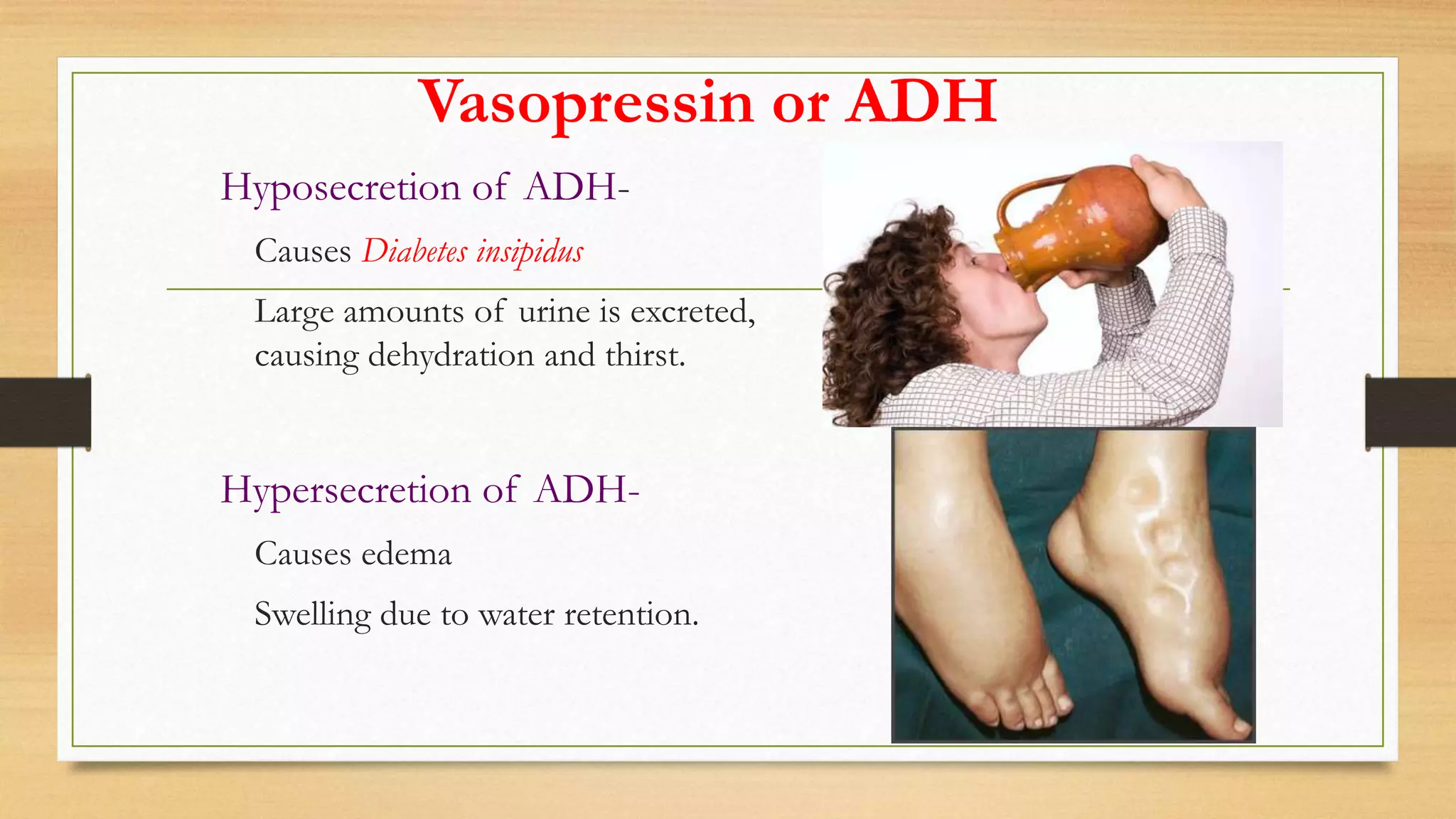 Vasopressin or ADH
Hyposecretion of ADH-
Causes Diabetes insipidus
Large amounts of urine is excreted,
causing dehydration and thirst.
Hypersecretion of ADH-
Causes edema
Swelling due to water retention.
 