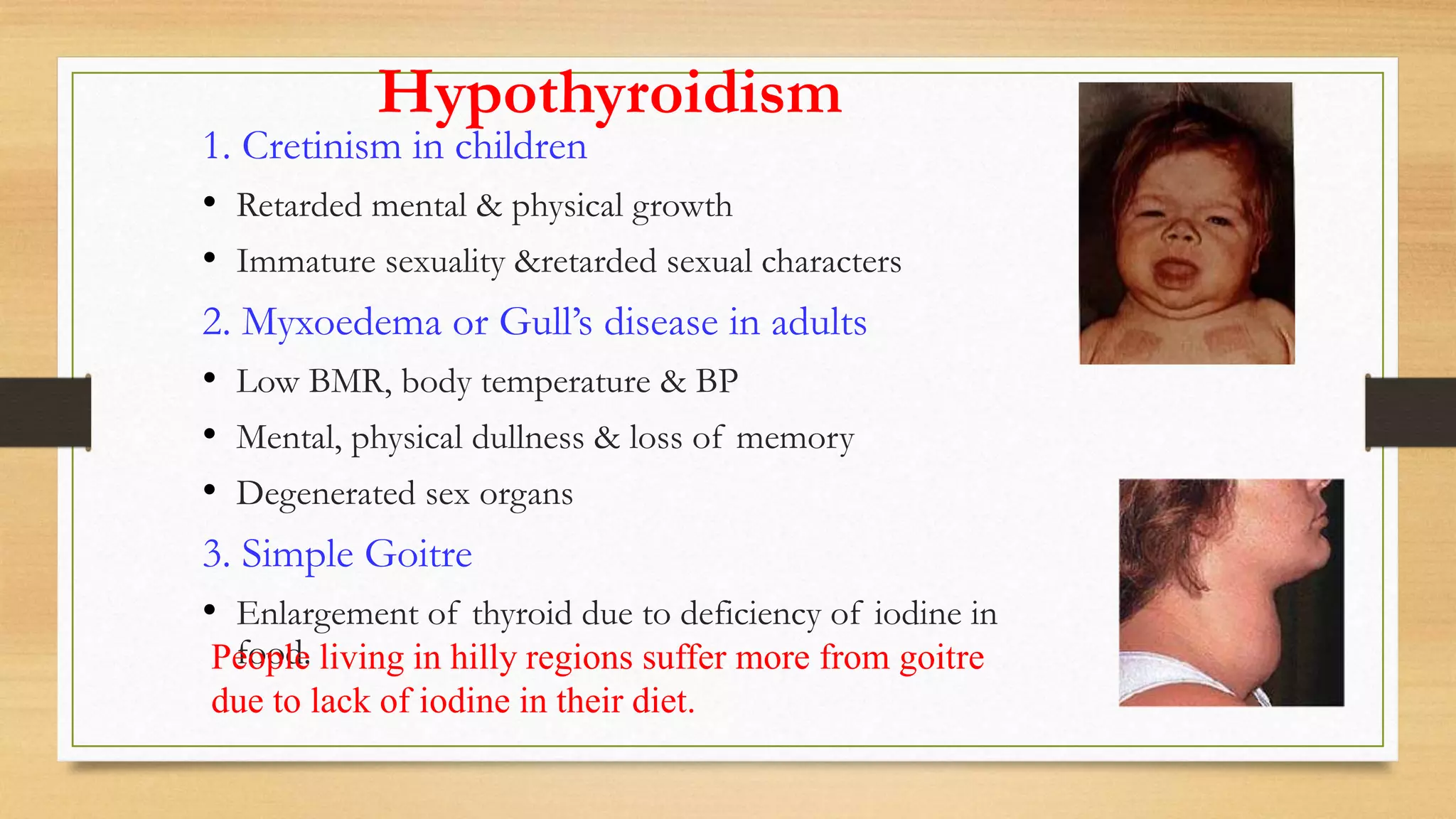 Hypothyroidism
1. Cretinism in children
• Retarded mental & physical growth
• Immature sexuality &retarded sexual characters
2. Myxoedema or Gull’s disease in adults
• Low BMR, body temperature & BP
• Mental, physical dullness & loss of memory
• Degenerated sex organs
3. Simple Goitre
• Enlargement of thyroid due to deficiency of iodine in
food.People living in hilly regions suffer more from goitre
due to lack of iodine in their diet.
 