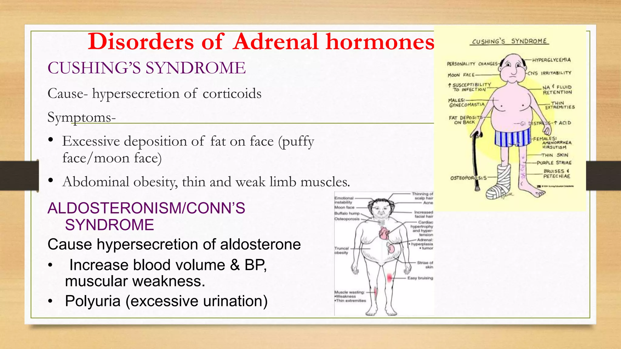 Disorders of Adrenal hormones
CUSHING’S SYNDROME
Cause- hypersecretion of corticoids
Symptoms-
• Excessive deposition of fat on face (puffy
face/moon face)
• Abdominal obesity, thin and weak limb muscles.
ALDOSTERONISM/CONN’S
SYNDROME
Cause hypersecretion of aldosterone
• Increase blood volume & BP,
muscular weakness.
• Polyuria (excessive urination)
 