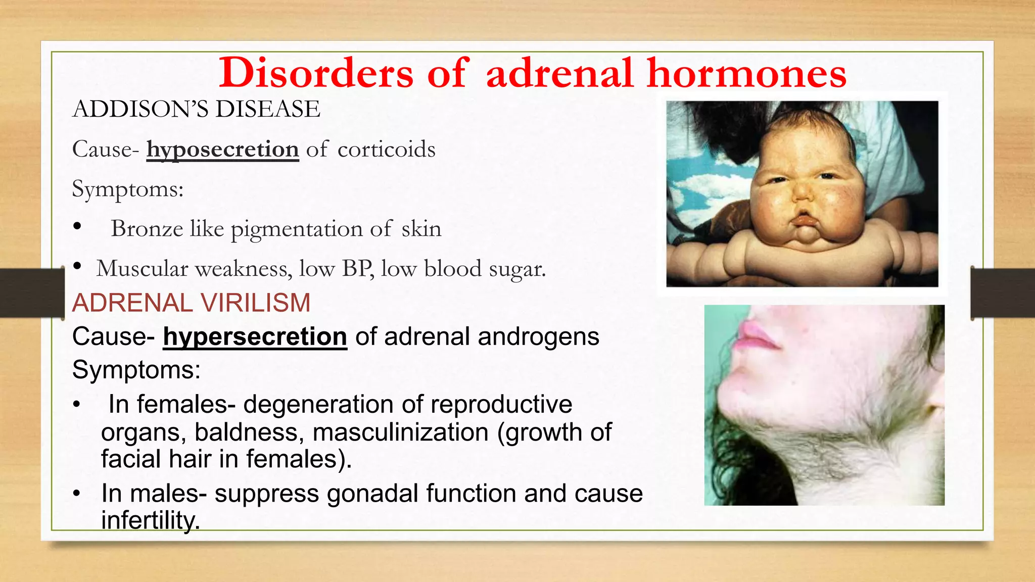Disorders of adrenal hormones
ADDISON’S DISEASE
Cause- hyposecretion of corticoids
Symptoms:
• Bronze like pigmentation of skin
• Muscular weakness, low BP, low blood sugar.
ADRENAL VIRILISM
Cause- hypersecretion of adrenal androgens
Symptoms:
• In females- degeneration of reproductive
organs, baldness, masculinization (growth of
facial hair in females).
• In males- suppress gonadal function and cause
infertility.
 