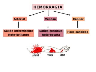 HEMORRAGIA
Arterial Venosa Capilar
Salida intermitente
Rojo-brillante
Salida continua
Rojo-oscura
Poca cantidad
 