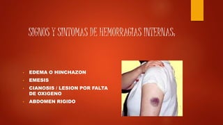 SIGNOS Y SINTOMAS DE HEMORRAGIAS INTERNAS:
• EDEMA O HINCHAZON
• EMESIS
• CIANOSIS / LESION POR FALTA
DE OXIGENO
• ABDOMEN RIGIDO
 