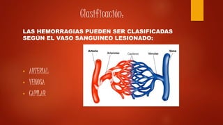 Clasificación:
LAS HEMORRAGIAS PUEDEN SER CLASIFICADAS
SEGÚN EL VASO SANGUINEO LESIONADO:
• ARTERIAL
• VENOSA
• CAPILAR
 