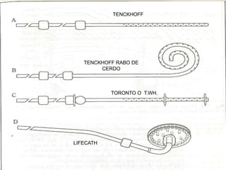Toronto Rabobank Control de liquidos (1) | PPTX