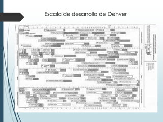 Escala de desarrollo de Denver
 