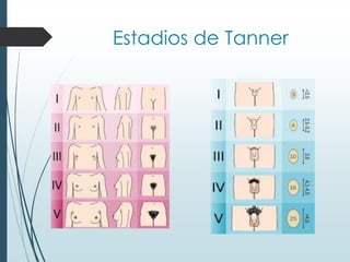 Estadios de Tanner
 
