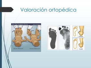 Valoración ortopédica
 