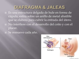    Es una estructura delgada de hule en forma de
    cúpula, estira sobre un anillo de metal abatible
    que se elabora para cubrir la entrada del útero.
   No interfiere con el desarrollo del coito y con el
    placer.
   Se remueve cada año.
 