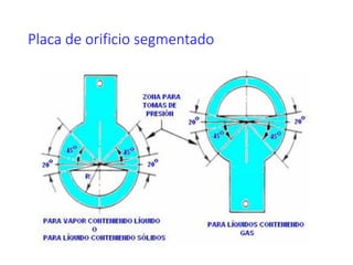 Placa de orificio segmentado
 
