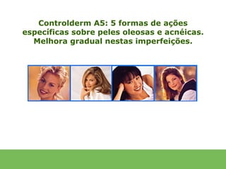 Controlderm A5: 5 formas de ações
específicas sobre peles oleosas e acnéicas.
  Melhora gradual nestas imperfeições.
 