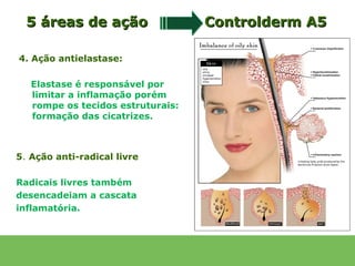 5 áreas de ação                  Controlderm A5

4. Ação antielastase:

   Elastase é responsável por
   limitar a inflamação porém
   rompe os tecidos estruturais:
   formação das cicatrizes.



5. Ação anti-radical livre

Radicais livres também
desencadeiam a cascata
inflamatória.
 