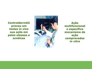 ControldermA5         Ação
   provou em      multifuncional
 testes in vivo    e específico
  sua ação em     mecanismo de
peles oleosas e        ação
    acnéicas      comprovados
                     in vitro
 