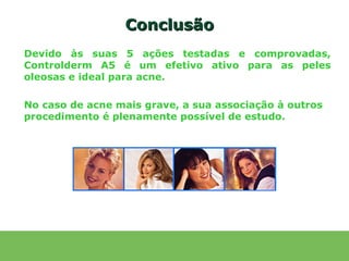 Conclusão
Devido às suas 5 ações testadas e comprovadas,
Controlderm A5 é um efetivo ativo para as peles
oleosas e ideal para acne.

No caso de acne mais grave, a sua associação à outros
procedimento é plenamente possível de estudo.
 