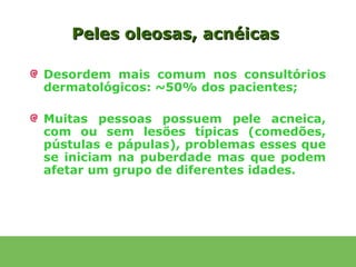 Peles oleosas, acnéicas

Desordem mais comum nos consultórios
dermatológicos: ~50% dos pacientes;

Muitas pessoas possuem pele acneica,
com ou sem lesões típicas (comedões,
pústulas e pápulas), problemas esses que
se iniciam na puberdade mas que podem
afetar um grupo de diferentes idades.
 