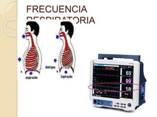 FRECUENCIA
RESPIRATORIA
 