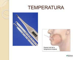 TEMPERATURA
 
