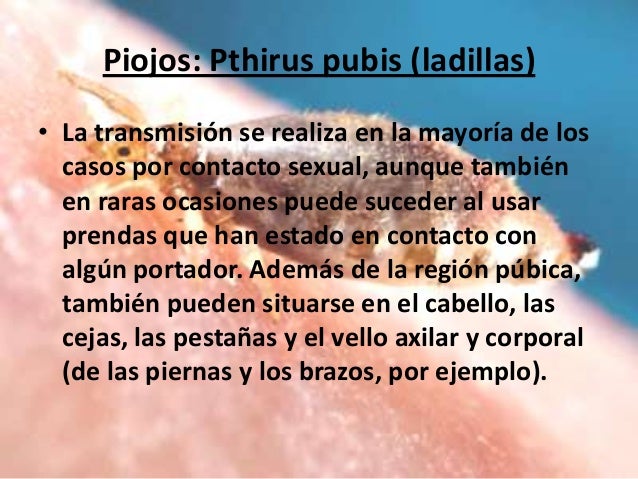 Los tipos de la curvatura de la columna vertebral y su tratamiento